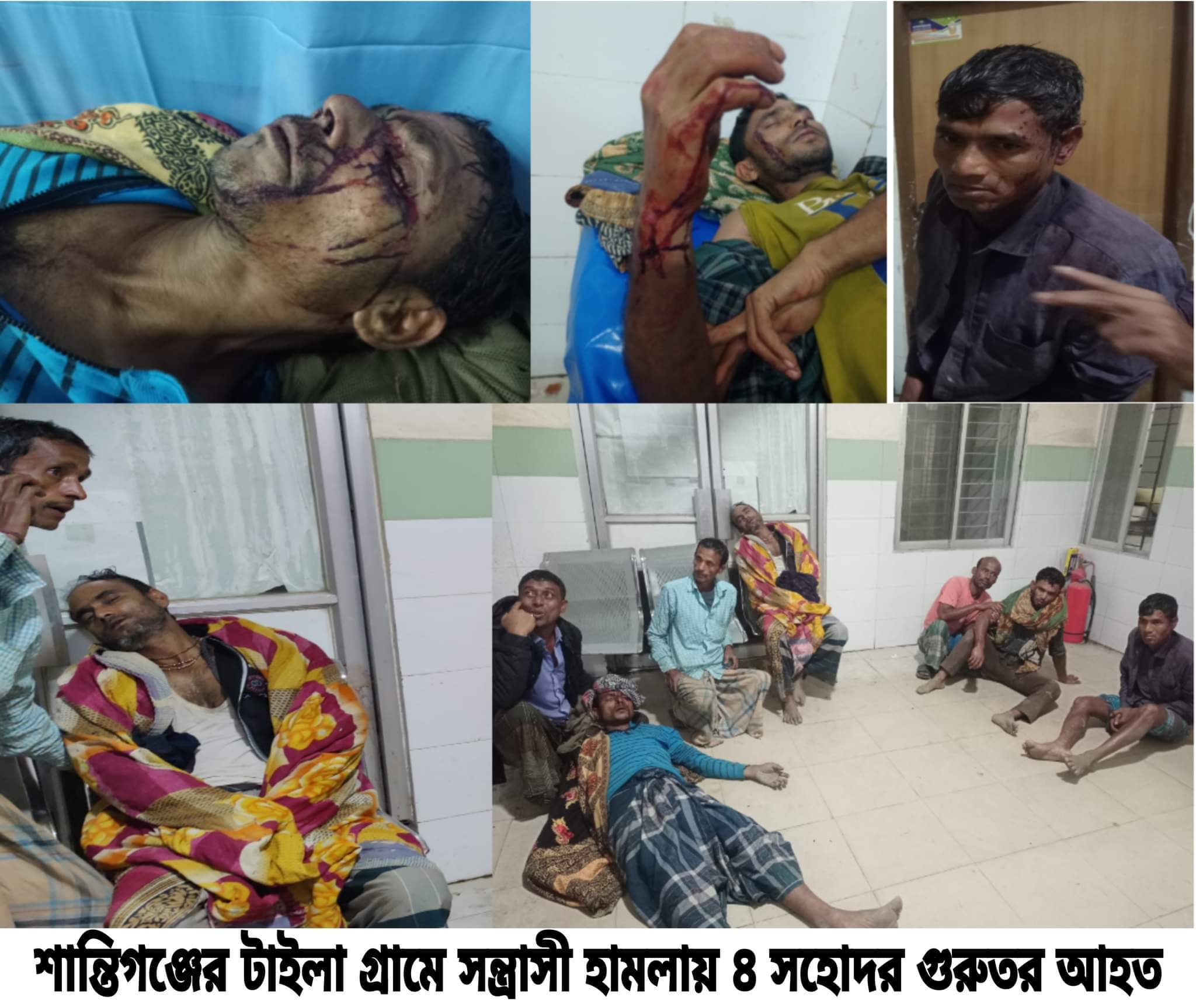 শান্তিগঞ্জের টাইলা বাজারে বাচ্ছাদের ঝগড়াকে কেন্দ্র করে সন্ত্রাসী হামলায় গুরুতর আহত ৪ জন