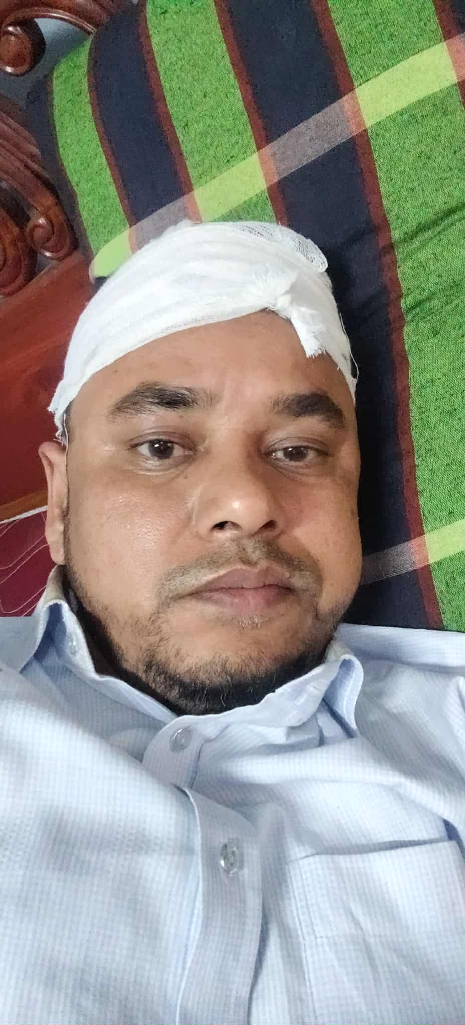 স্বপ্নপুরী ঘুরতে গিয়ে সাংবাদিক মাসুদ রানা গুরুতর আহত